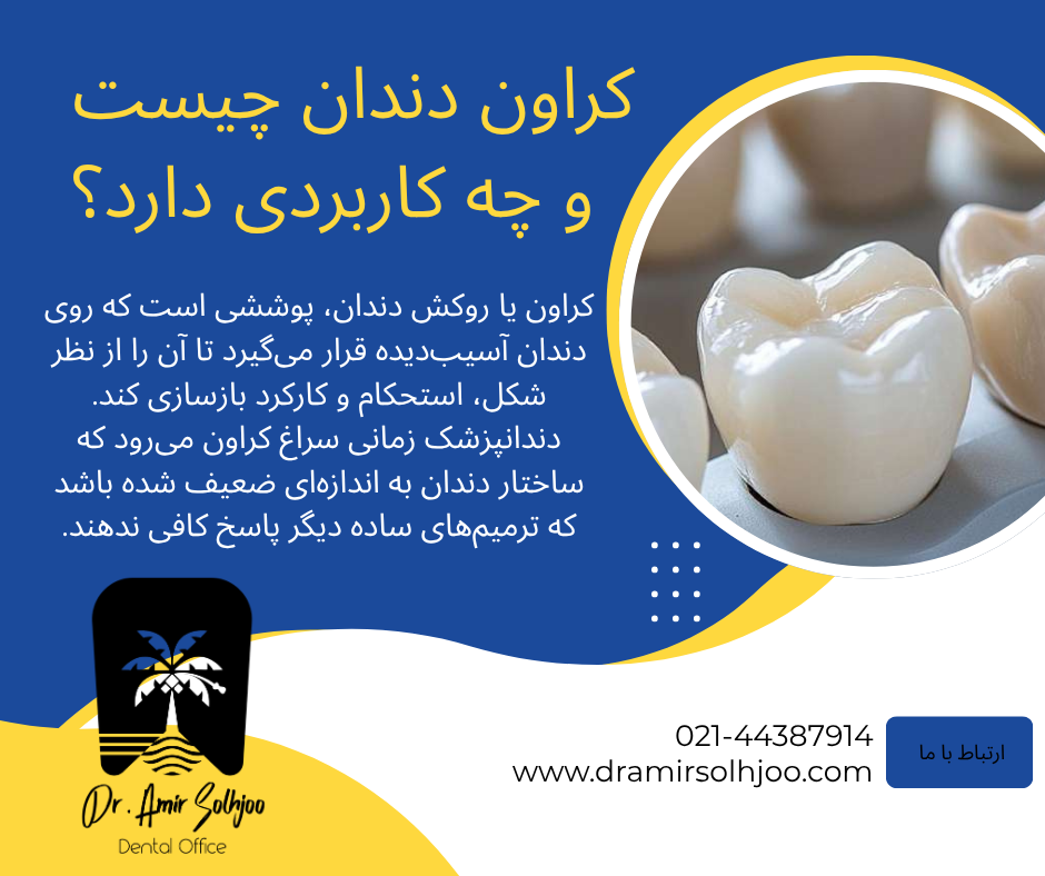 قیمت کراون دندان