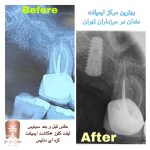 مرکز ایمپلنت مرزداران