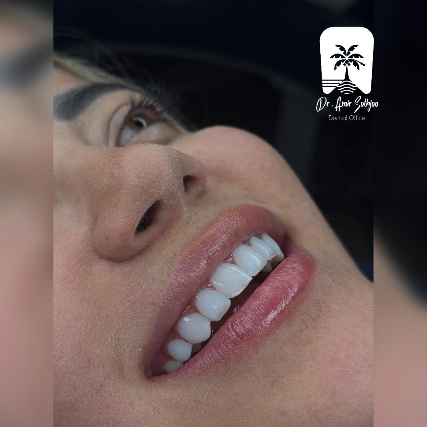 بهترین دکتر کامپوزیت تهران
