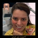 بهترین کلینیک کامپوزیت تهران