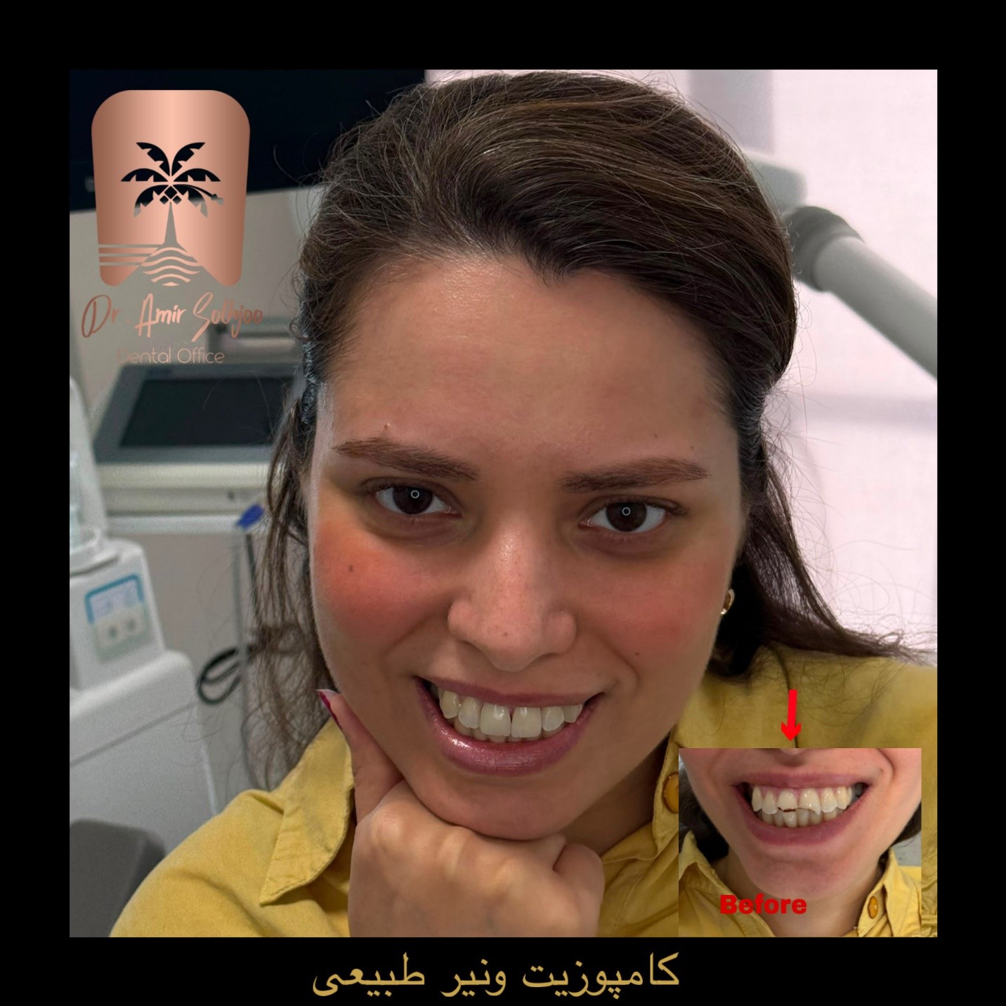 بهترین کلینیک کامپوزیت تهران