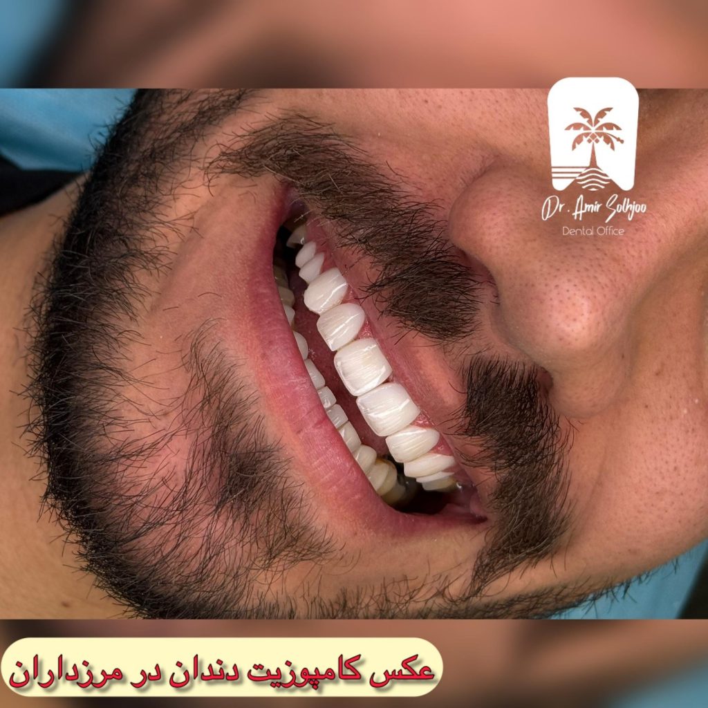 بهترین دندانپزشک زیبایی در تهران