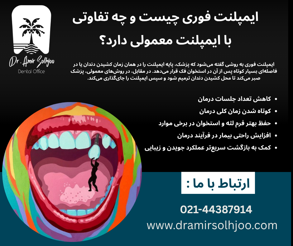 بهترین دکتر ایمپلنت فوری در تهران