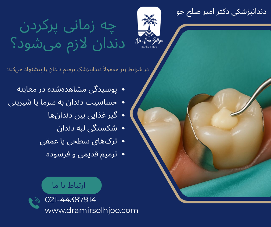 هزینه پر کردن دندان
