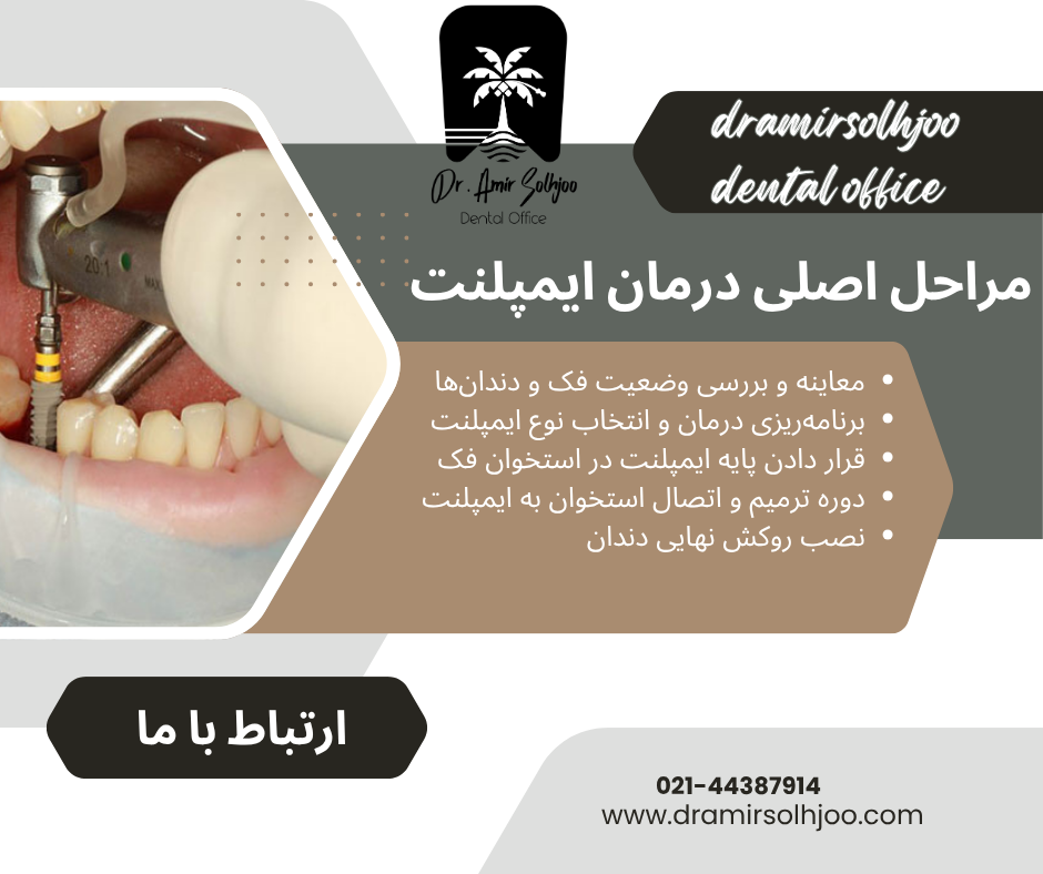 کاشت ایمپلنت دندان در سعادت آباد