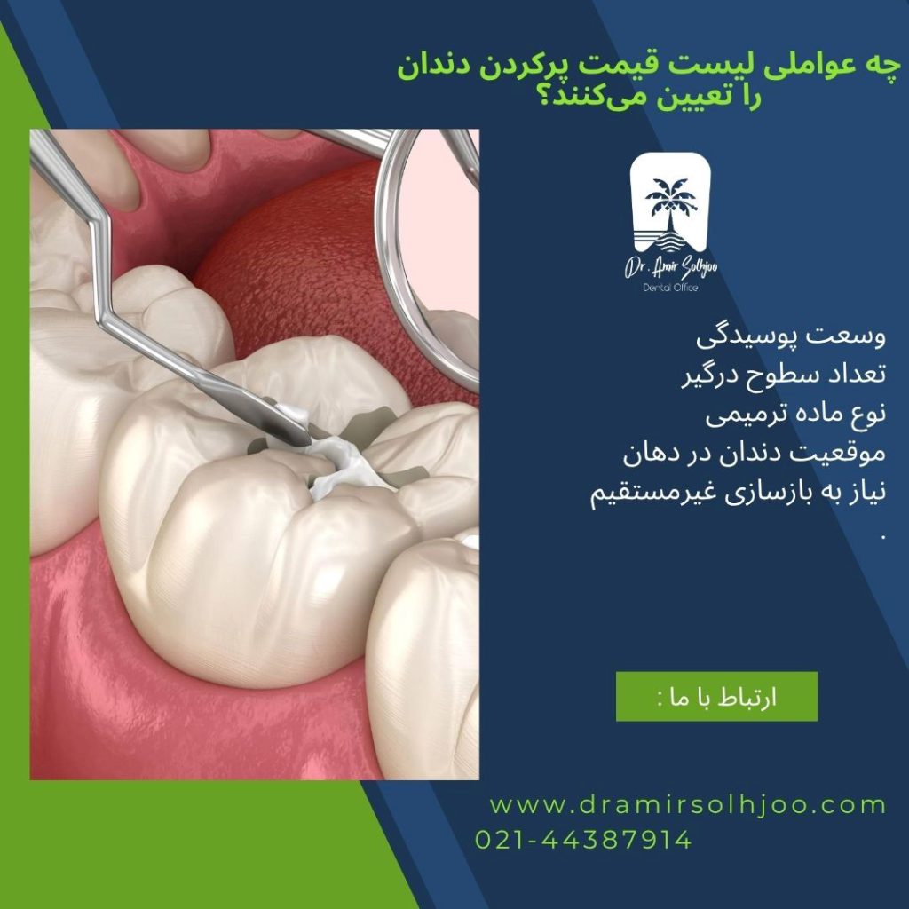 لیست قیمت پرکردن دندان