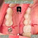 مرکز ایمپلنت غرب تهرانسر
