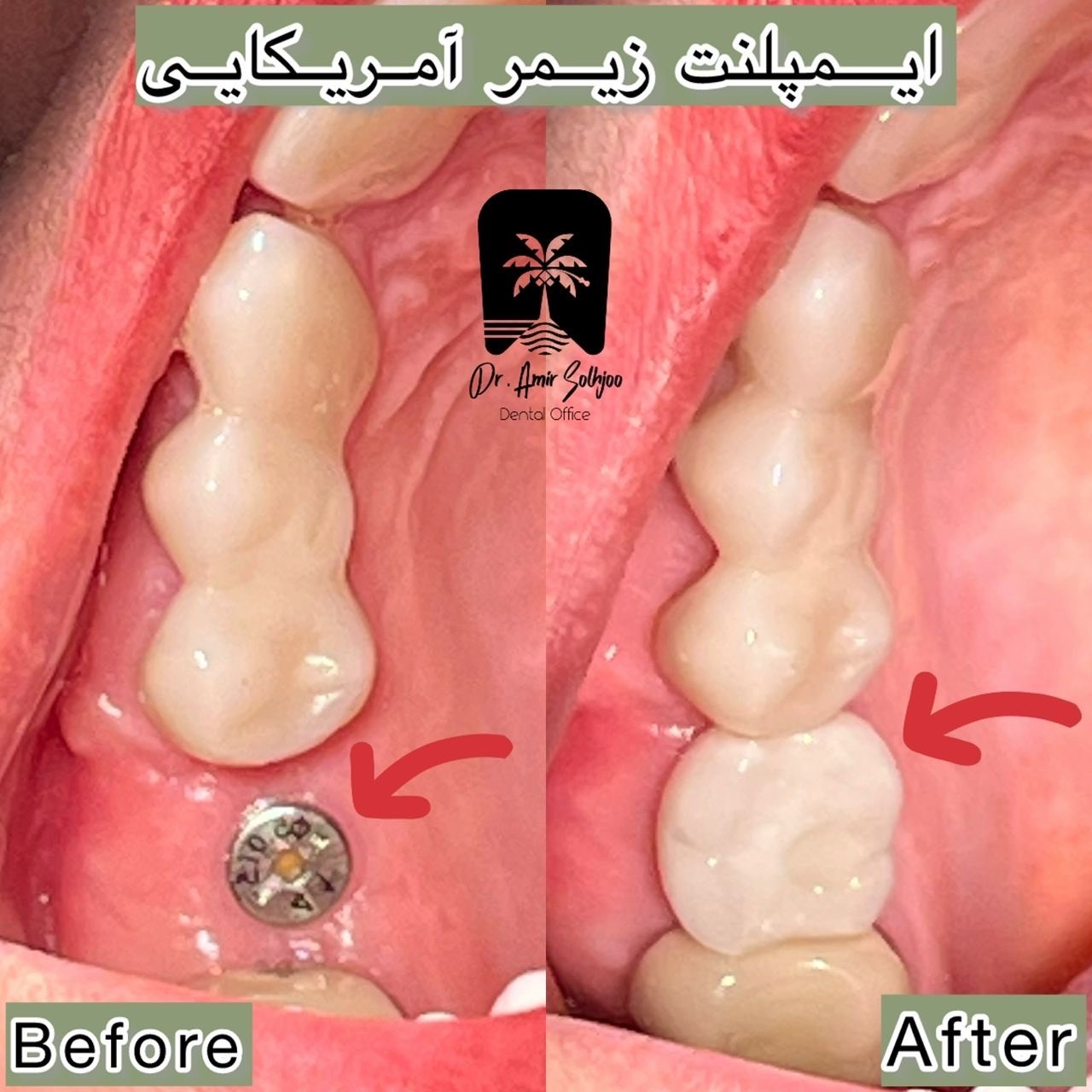 مرکز ایمپلنت غرب تهرانسر