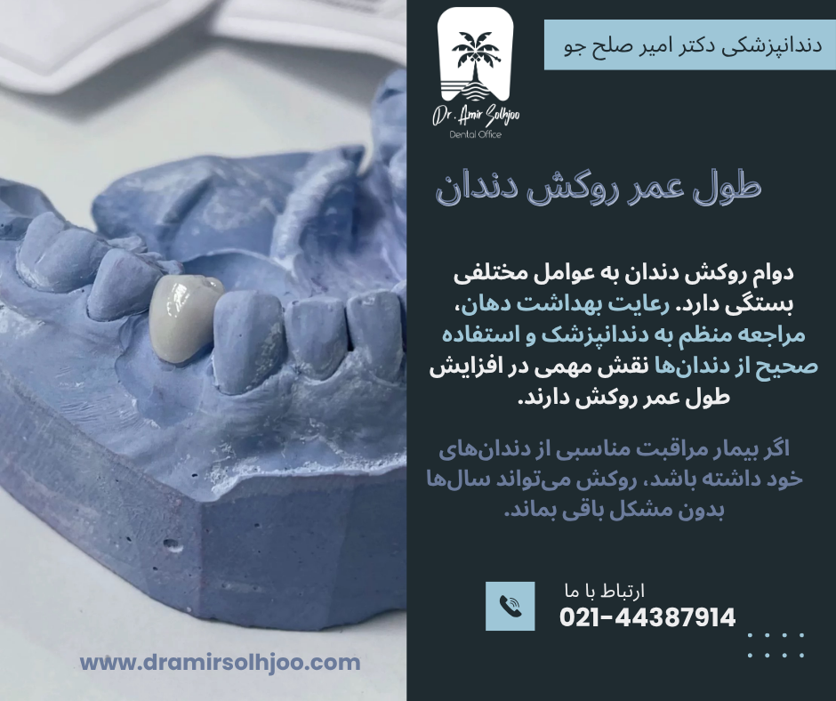 هزینه روکش دندان