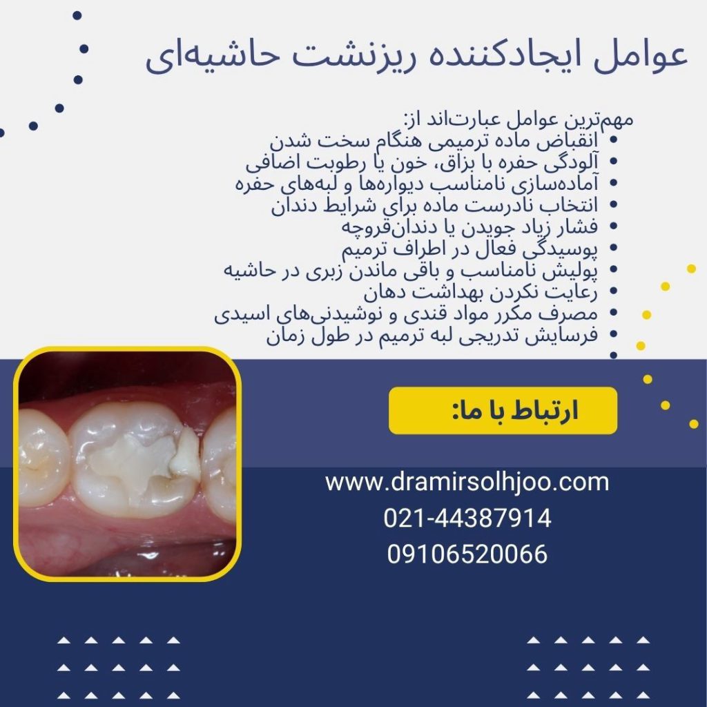 نقش ریزنشت حاشیهای در شکست ترمیم