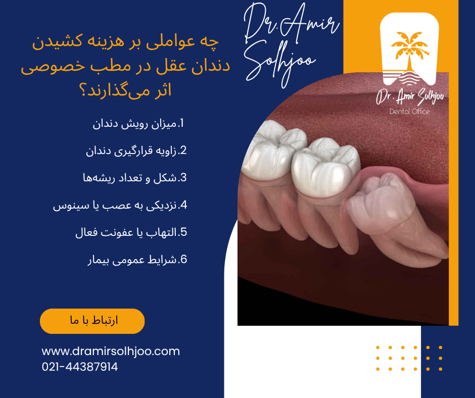 هزینه کشیدن دندان عقل در مطب خصوصی