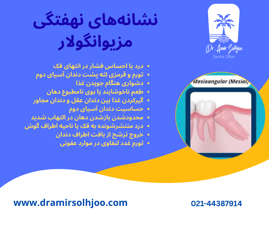 نهفتگی مزیوانگولار دندان عقل