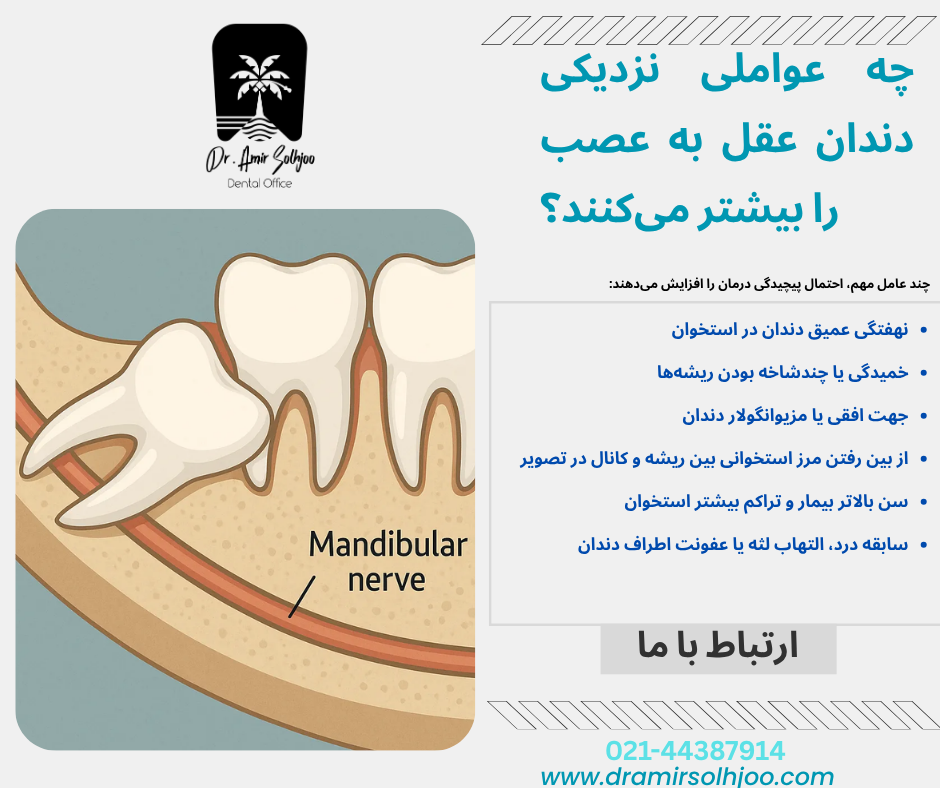 ارتباط مولر سوم با کانال عصبی