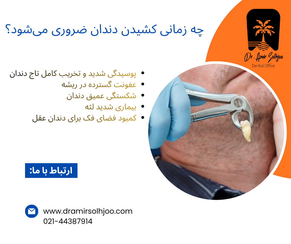 هزینه کشیدن دندان