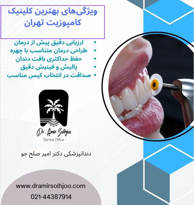 بهترین کلینیک کامپوزیت تهران