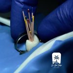 تحلیل ساختار دندان