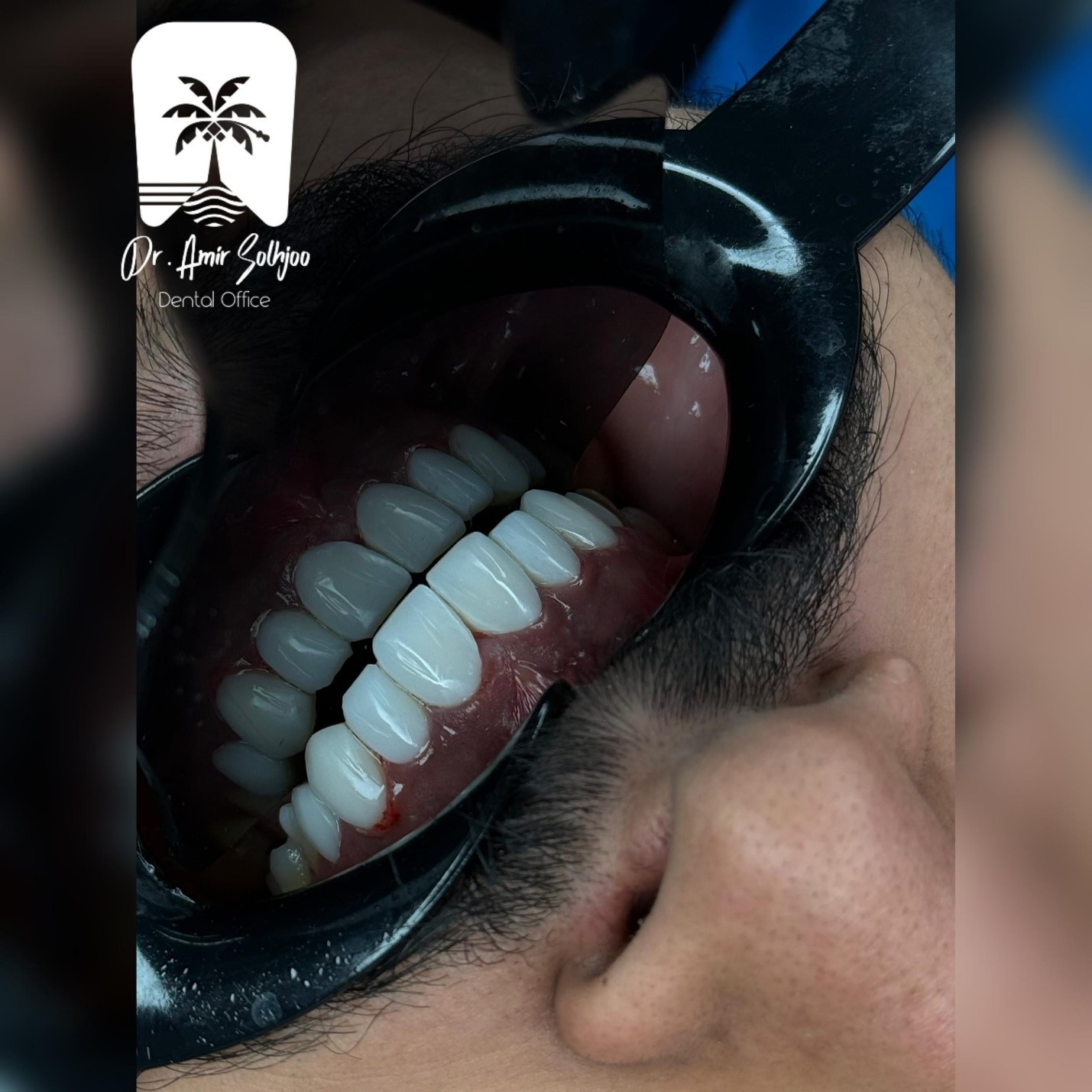 بهترین دندانپزشک زیبایی در تهران