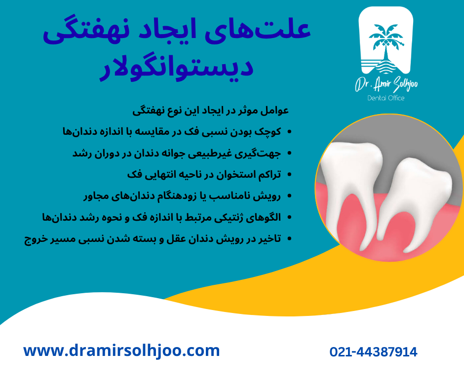 نهفتگی دیستوانگولار