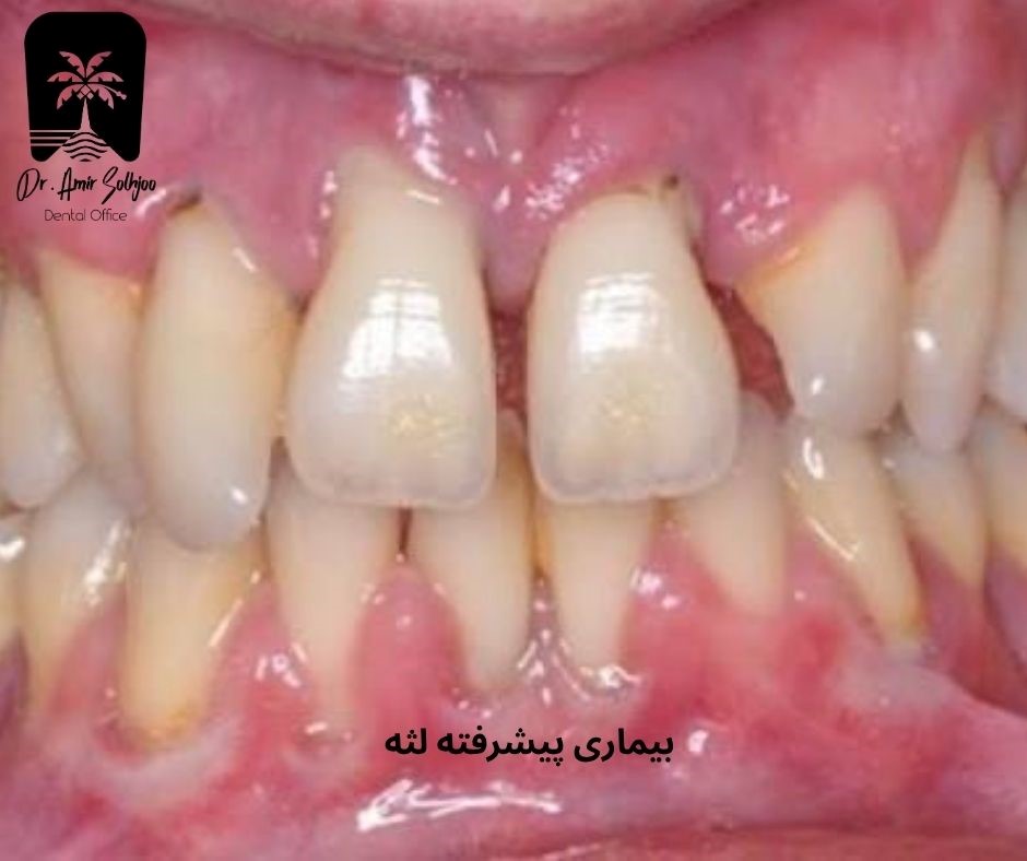 ارزیابی کلینیکی در دندانپزشکی