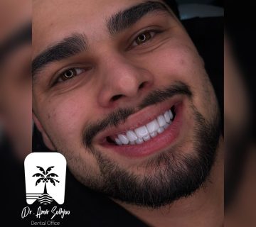 قیمت کامپوزیت دندان در تهران