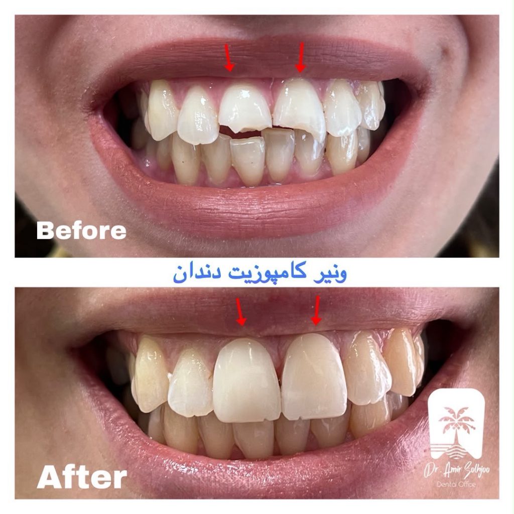 بهترین کلینیک کامپوزیت تهران