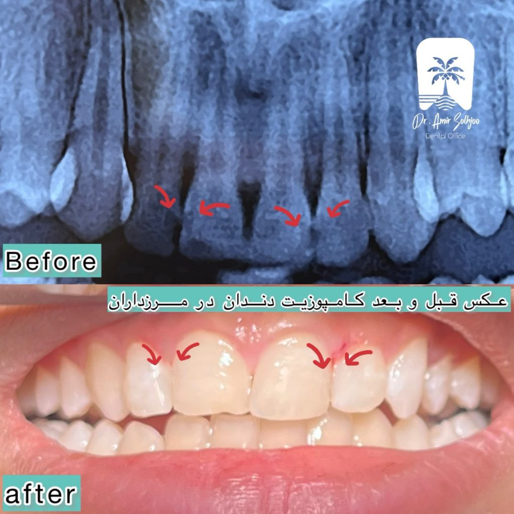 بهترین دندانپزشک زیبایی در تهران