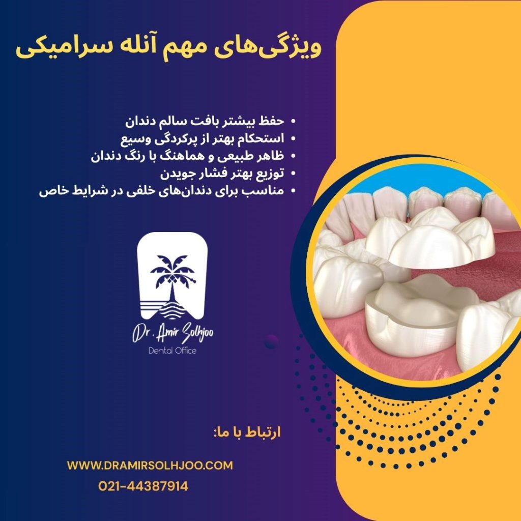 هزینه آنله سرامیکی
