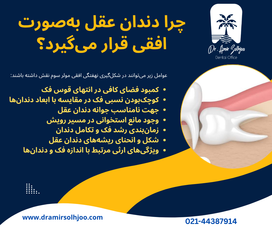 نهفتگی افقی مولر سوم