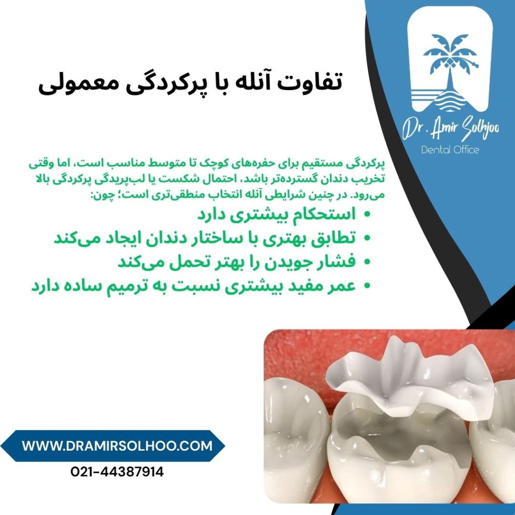 قیمت آنله دندان