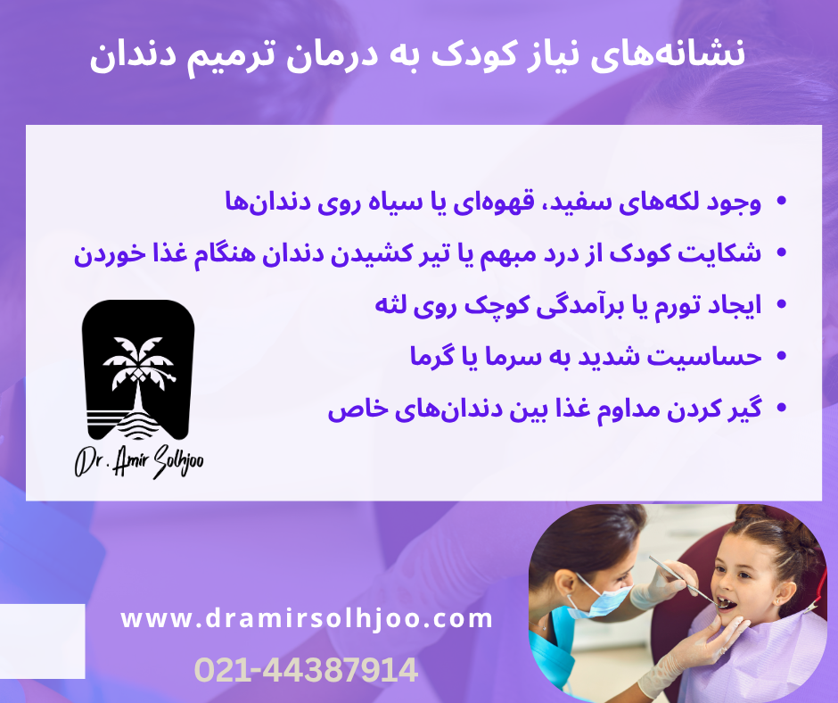 پر کردن دندان شیری
