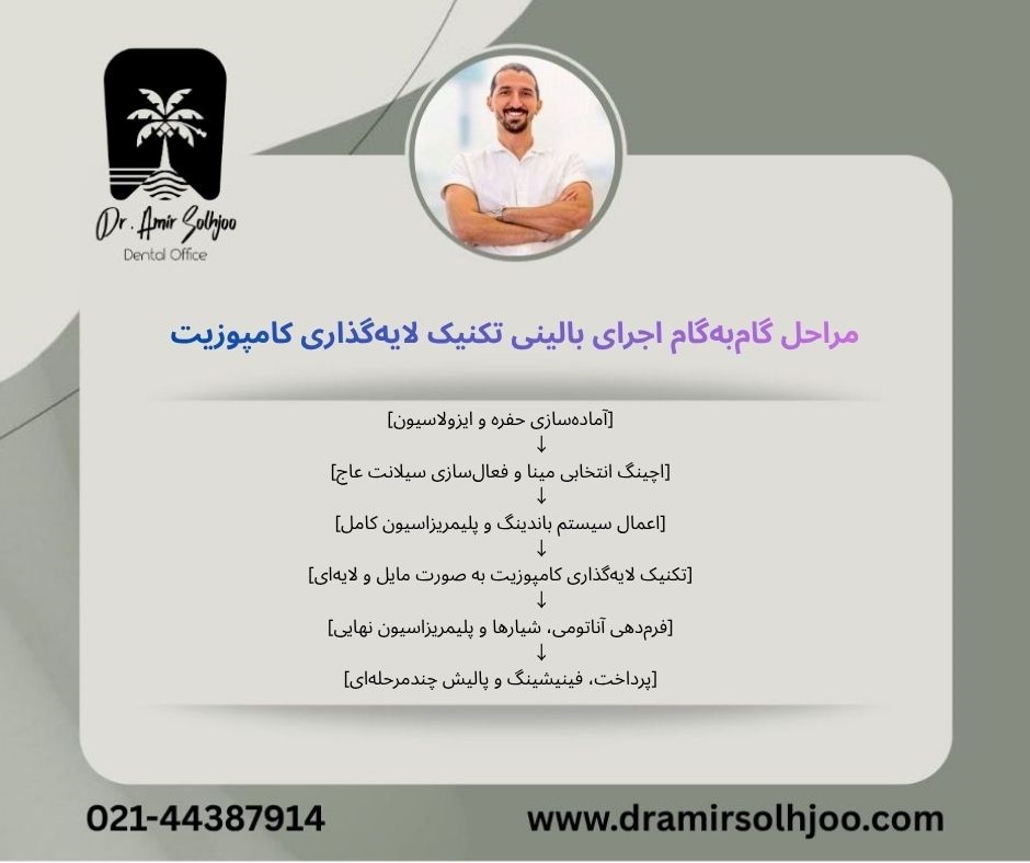 تکنیک لایهگذاری کامپوزیت