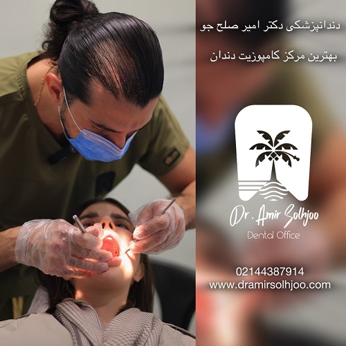 بهترین مرکز کامپوزیت دندان در تهران