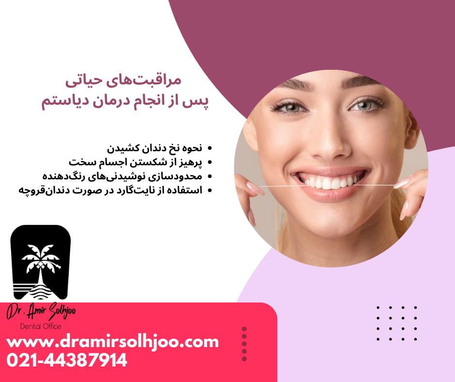 بستن دیاستم با کامپوزیت بدون تراش