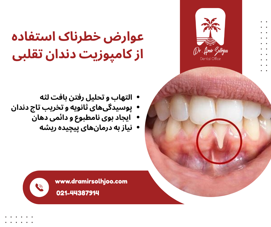 تشخیص کامپوزیت