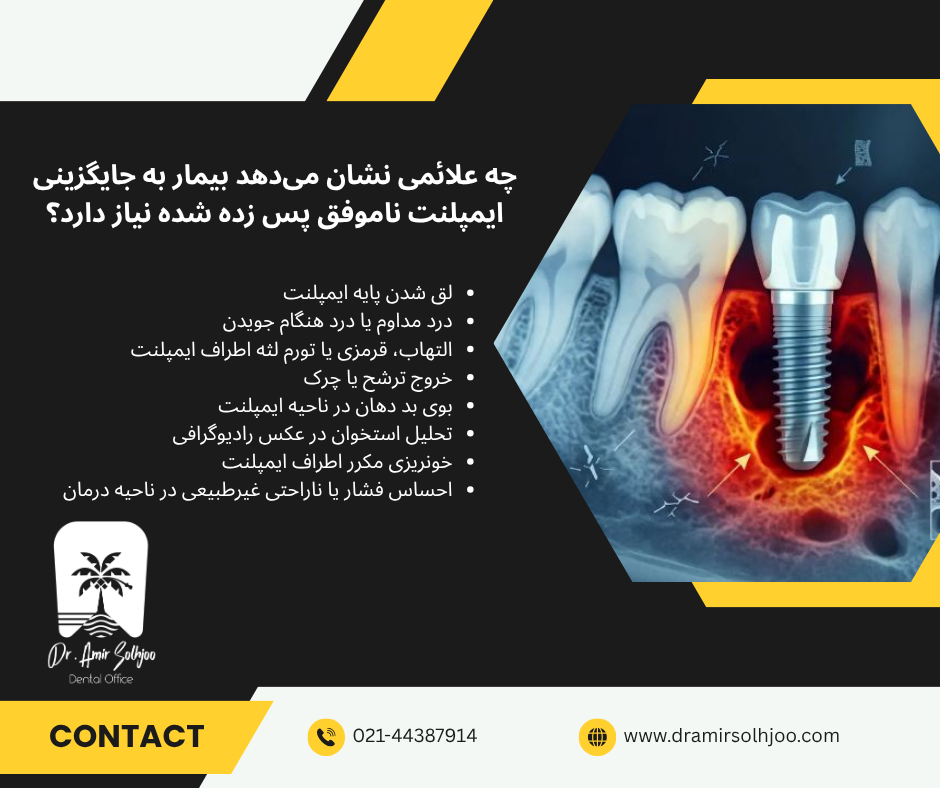 جایگزینی ایمپلنت ناموفق
