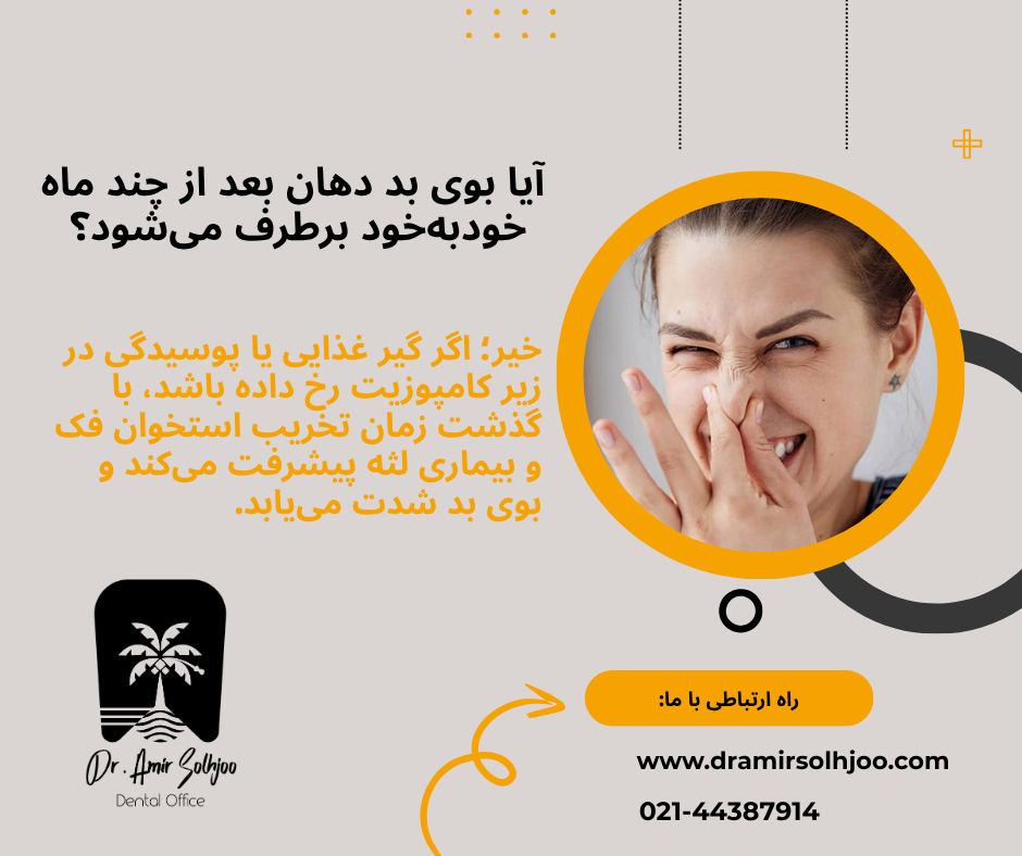 علت بوی بد دهان بعد از کامپوزیت