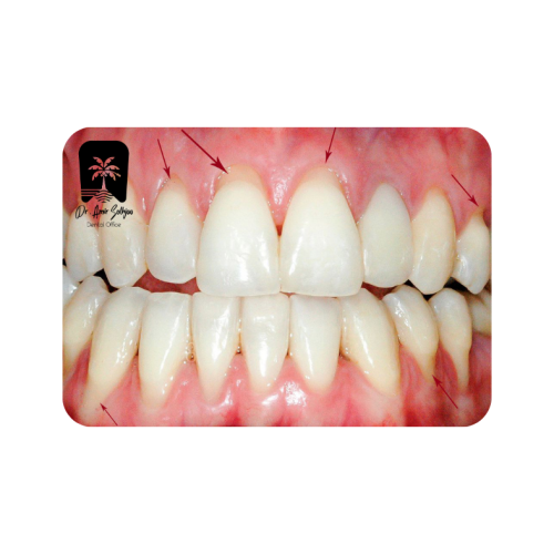 تشخیص کامپوزیت